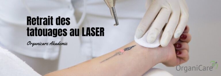 Retrait des tatouages au laser