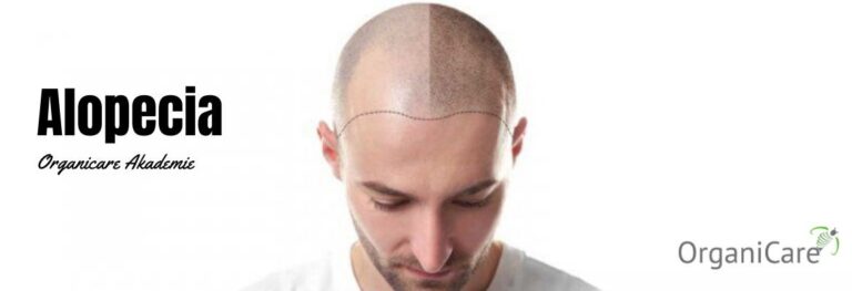Cours Alopecia: diagnostic et traitement